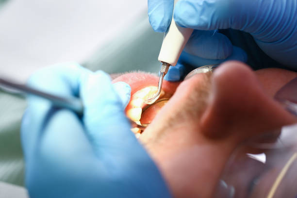 Best Emergency Dental Care for Trauma or Injury in North Seekonk, MA