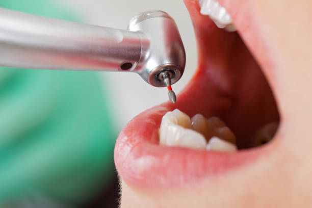 Best Emergency Treatment for Toothache in North Seekonk, MA